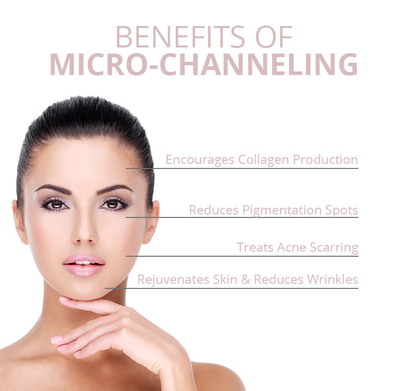 Micro Channeling