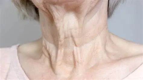 The Radiant NECK
